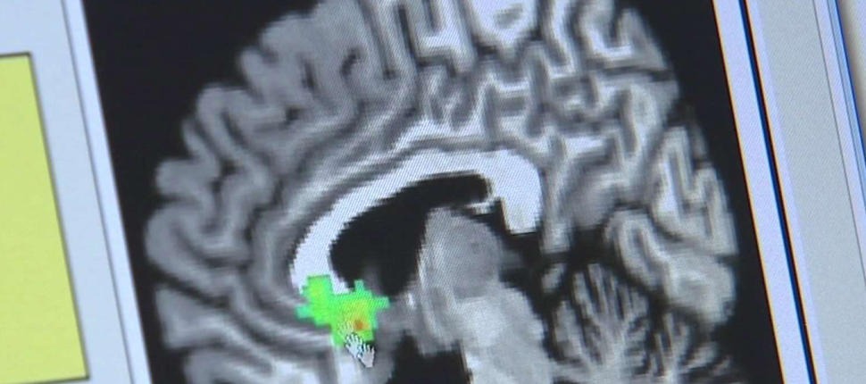 image of a brain scan